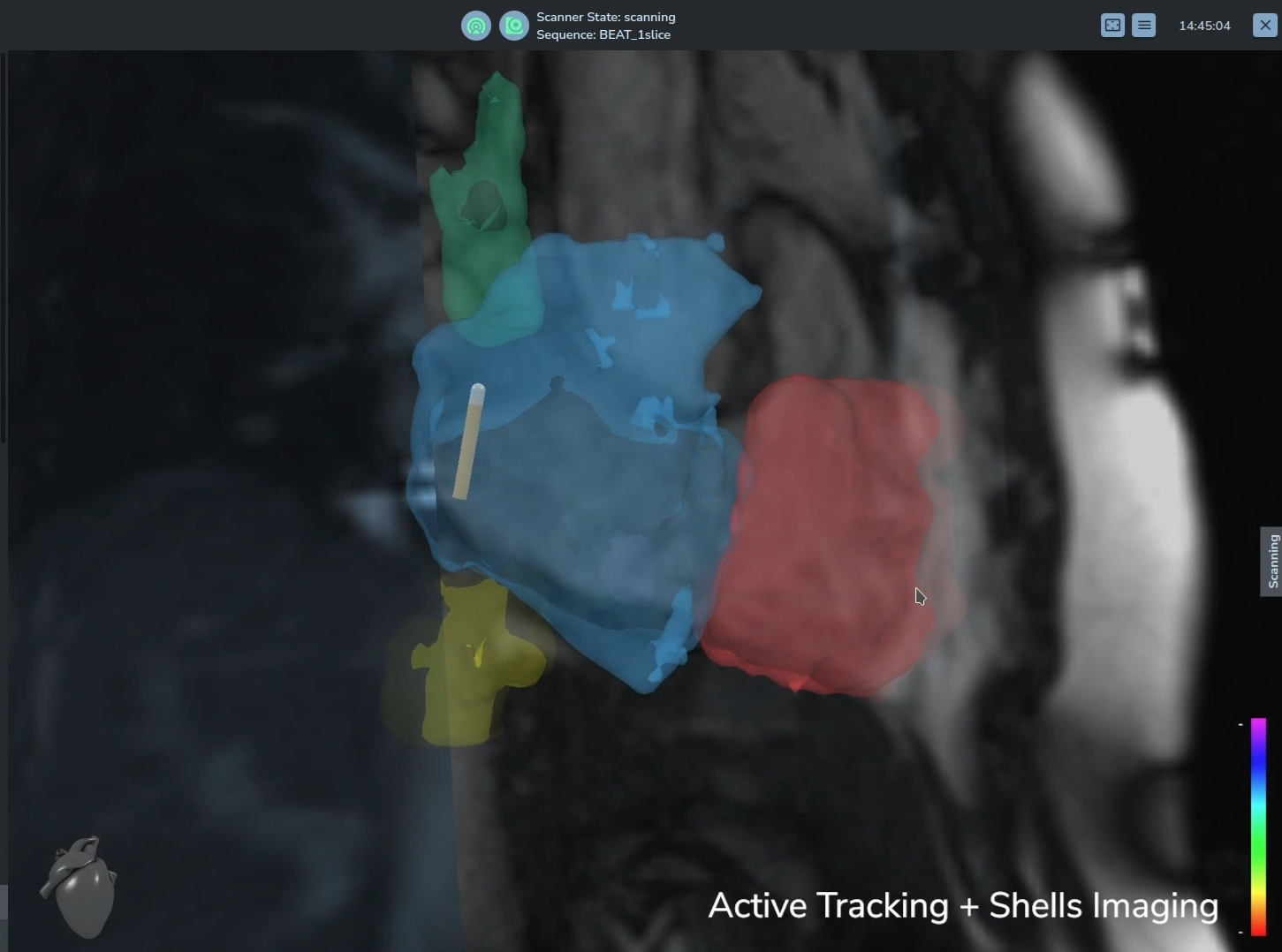 NorthStar guided imaging