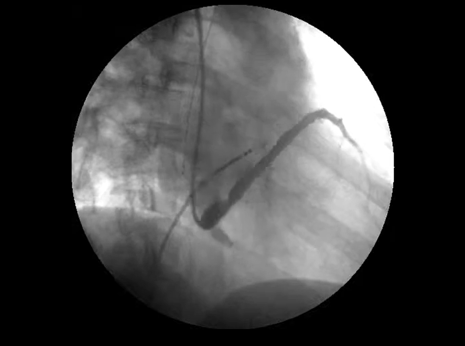 X-ray guided imaging